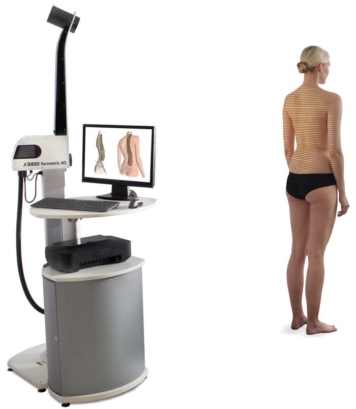 Formetric radiation-free back scanning system